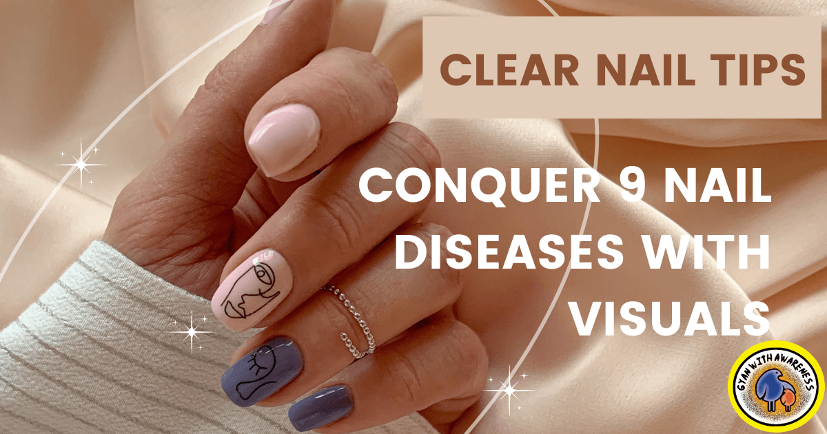 Clear Nail Tips: Conquer 9 Nail Diseases with Visuals