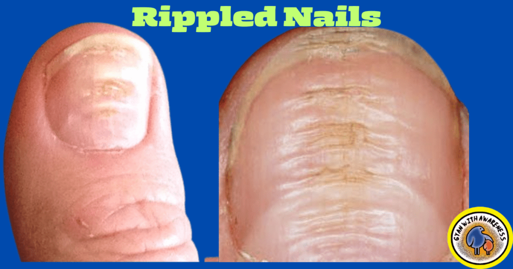 Clear Nail Tips: Conquer 9 Nail Diseases with Visuals