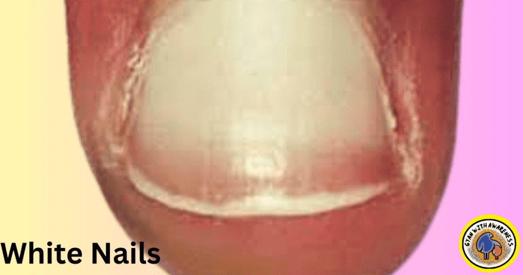 Clear Nail Tips: Conquer 9 Nail Diseases with Visuals