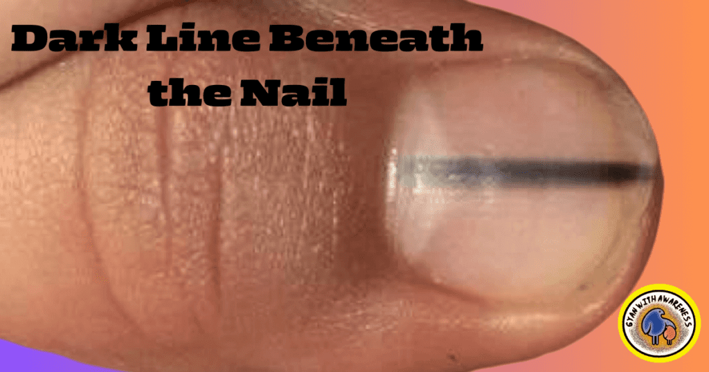 Clear Nail Tips: Conquer 9 Nail Diseases with Visuals