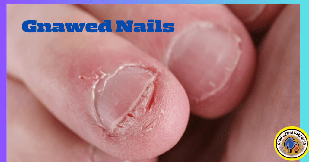 Clear Nail Tips: Conquer 9 Nail Diseases with Visuals