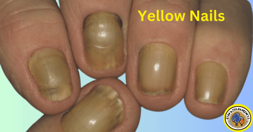 Clear Nail Tips: Conquer 9 Nail Diseases with Visuals