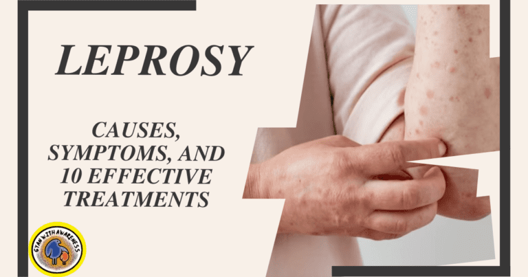 Leprosy: Causes, Symptoms, and 10 Effective Treatments